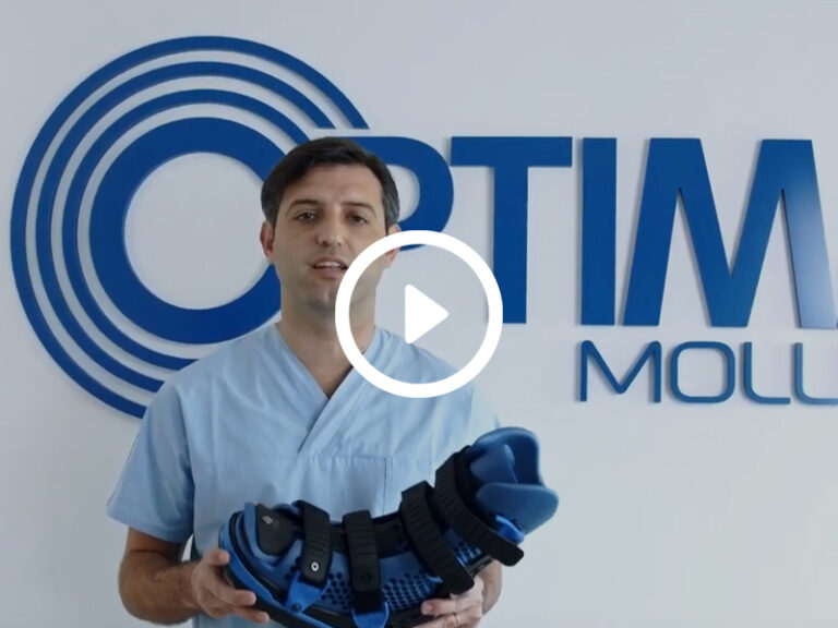 SBI il primo tutore completamente customizzabile + Kit3X3